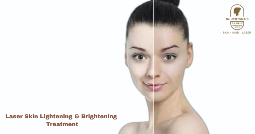 Laser Skin Lightening & Brightening Treatment