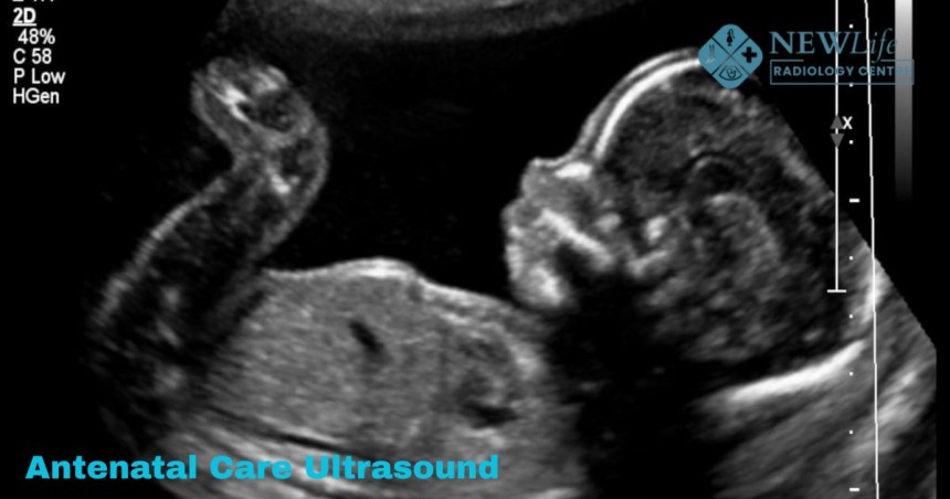 Antenatal Care Ultrasound in Thane: A Simple Guide for Expecting Parents