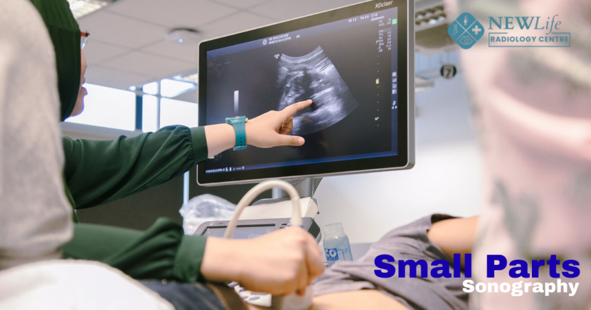 Small Parts Sonography Treatment