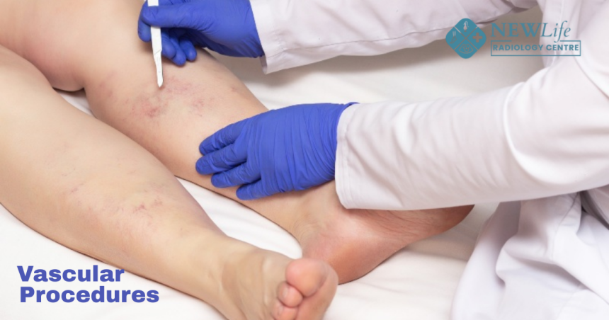 Vascular Procedures in Thane – Advanced Imaging and Interventions at New Life Radiology Centre