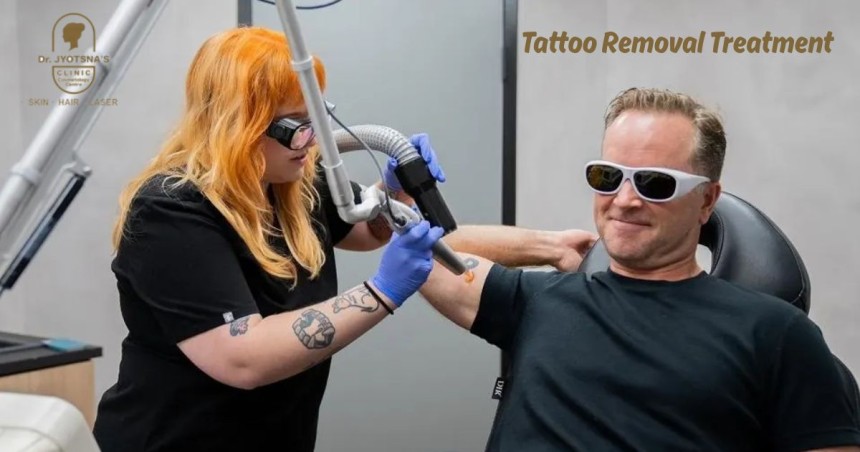 Tattoo Removal Treatment in Thane - Clear Skin, Fresh Start with Jyotsna Clinic