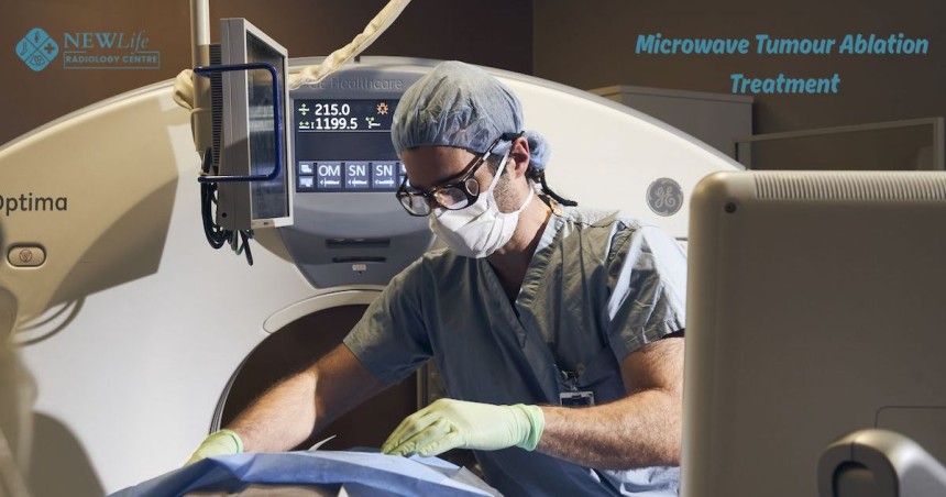 Microwave Tumour Ablation Treatment