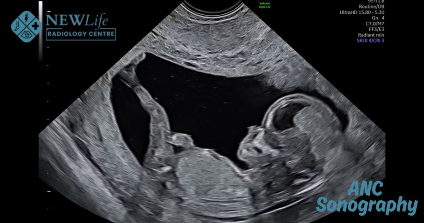 Best Sonologist in Thane – Your Guide to ANC Sonography in Thane