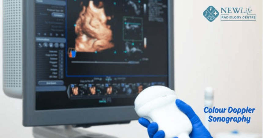 The Role of Colour Doppler Sonography in Women’s Health
