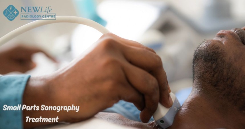Small Parts Sonography Treatment